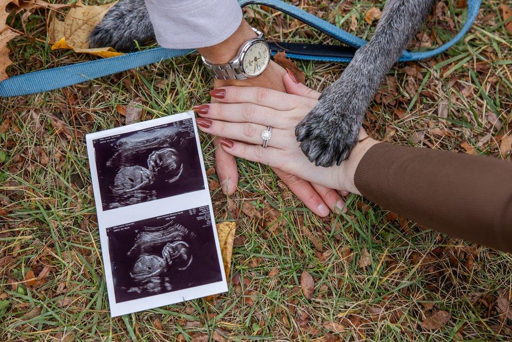 recomment-pack-image-1